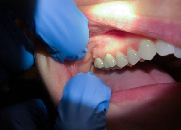 Best Cosmetic Emergency Dentistry in Montclair, CA