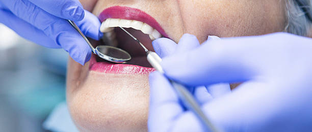 Best Emergency Treatment for Dental Infections or Abscesses in Montclair, CA