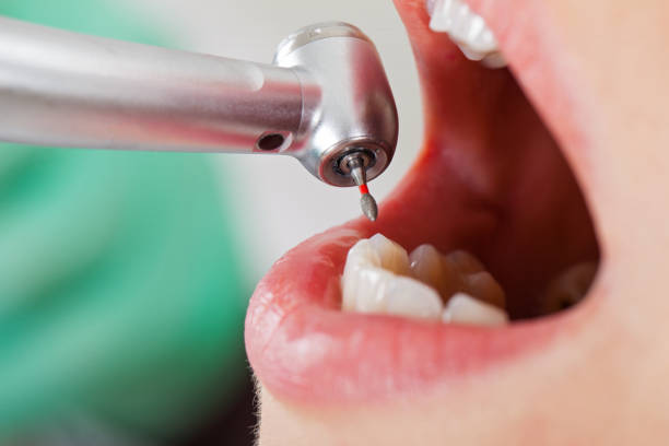 Best Pediatric Emergency Dentist in Montclair, CA